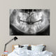 x-ray of jaw with teeth and milk teeth Wall Mural