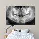 x-ray of jaw with teeth and milk teeth Wall Mural