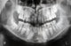 x-ray of jaw with teeth and milk teeth Wall Mural