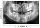 x-ray of jaw with teeth and milk teeth Wall Mural