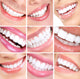Smile and Teeth 3x3 Image Grid Wall Decal