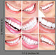 Smile and Teeth 3x3 Image Grid Wall Decal