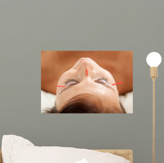Anti-aging Acupuncture Treatment Wall Decal