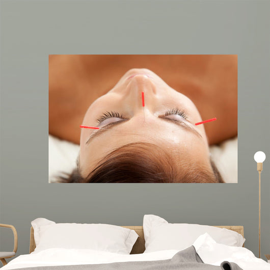 Anti-aging Acupuncture Treatment Wall Decal