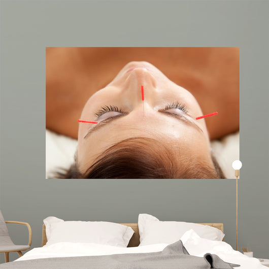 Anti-aging Acupuncture Treatment Wall Decal
