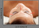 Anti-aging Acupuncture Treatment Wall Decal