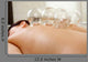 Fire Cupping Wall Decal