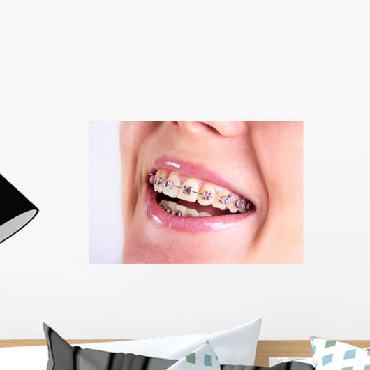 Teeth With Braces Wall Decal