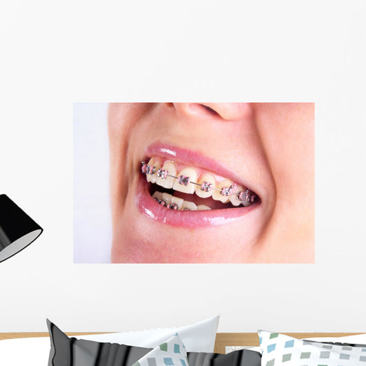 Teeth With Braces Wall Decal