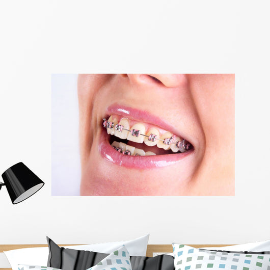 Teeth With Braces Wall Decal