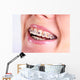 Teeth With Braces Wall Decal