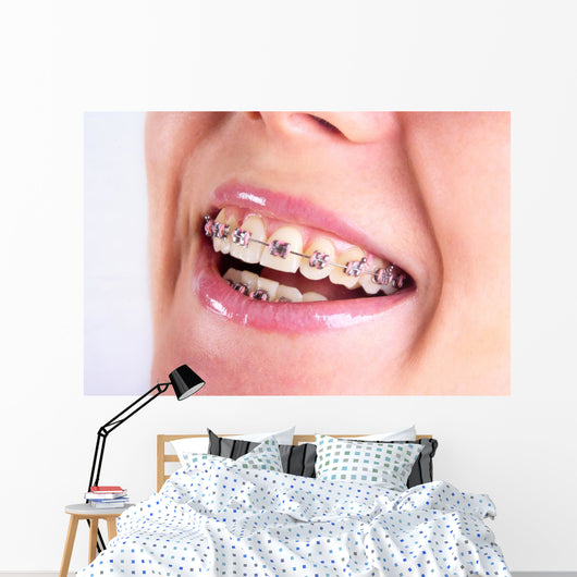 Teeth With Braces Wall Decal