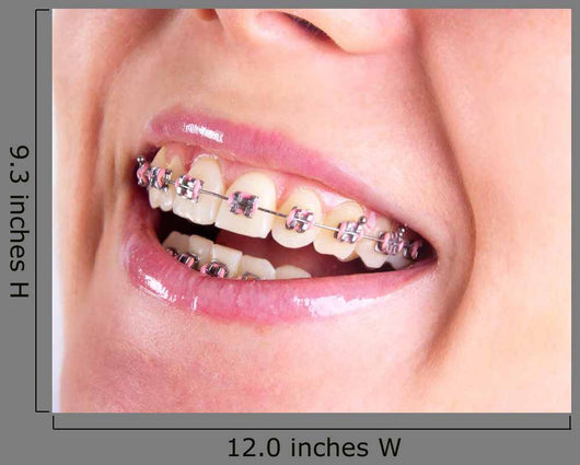 Teeth With Braces Wall Decal