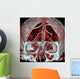 Mri Mra Brain Vasculature Wall Decal