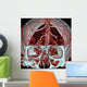 Mri Mra Brain Vasculature Wall Decal
