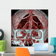 Mri Mra Brain Vasculature Wall Decal