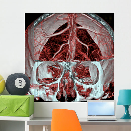Mri Mra Brain Vasculature Wall Decal