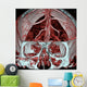Mri Mra Brain Vasculature Wall Decal