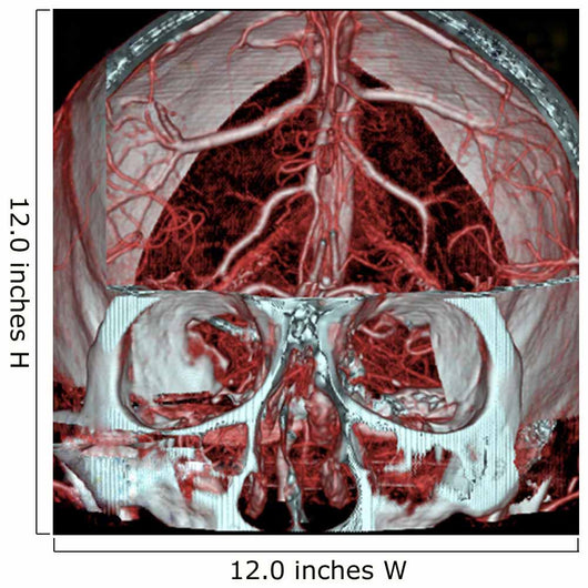 Mri Mra Brain Vasculature Wall Decal