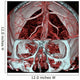 Mri Mra Brain Vasculature Wall Decal