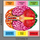 Human Brain Underside - Horizontal Wall Decal