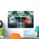 Dental Xray Wall Decal