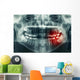 Dental Xray Wall Decal