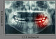 Dental Xray Wall Decal