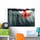Dental Xray With Red Wall Decal