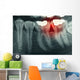 Dental Xray With Red Wall Decal