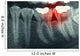 Dental Xray With Red Wall Decal