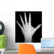 X-Ray Human Hand Wall Decal
