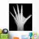 X-Ray Human Hand Wall Decal