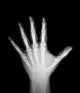 X-Ray Human Hand Wall Decal