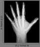 X-Ray Human Hand Wall Decal