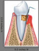 Periodontitis Half Wall Decal