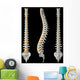 Views Spine Wall Decal