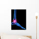 Foot Skeleton With Pain Wall Decal