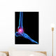 Foot Skeleton With Pain Wall Decal