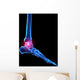 Foot Skeleton With Pain Wall Decal