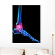 Foot Skeleton With Pain Wall Decal