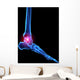 Foot Skeleton With Pain Wall Decal