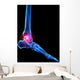 Foot Skeleton With Pain Wall Decal