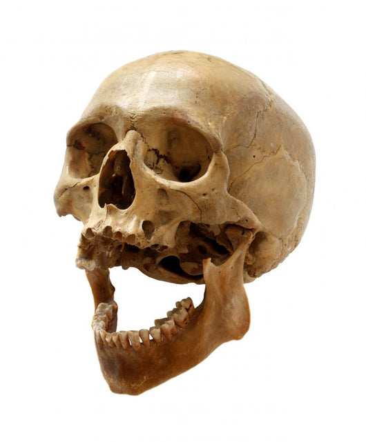 Skull of the person. Wall Decal