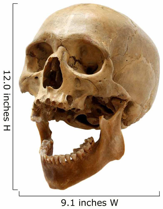 Skull of the person. Wall Decal