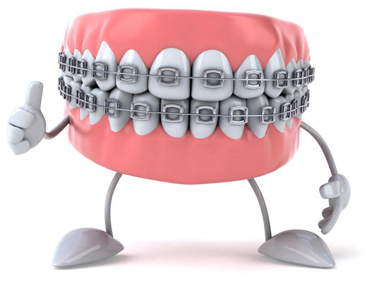 Friendly Braces Dental Wall Decal