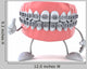 Friendly Braces Dental Wall Decal
