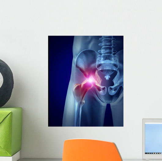 Hip Pain