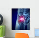 Hip Pain