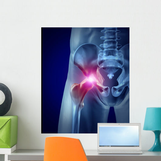 Hip Pain